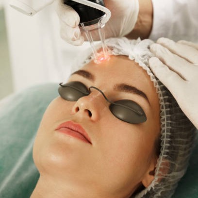 CO2 Laser Treatment